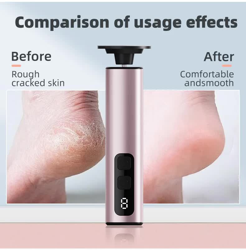 9-Speed Rechargeable Electric Foot File Callus Remover - Purple - Image 14